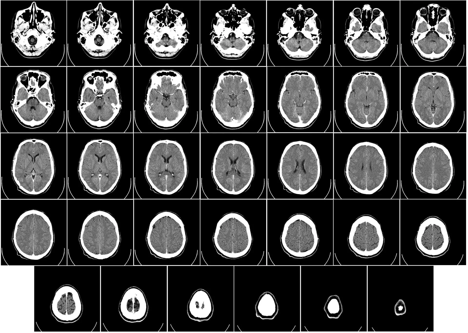 Computed tomography slices of a human brain