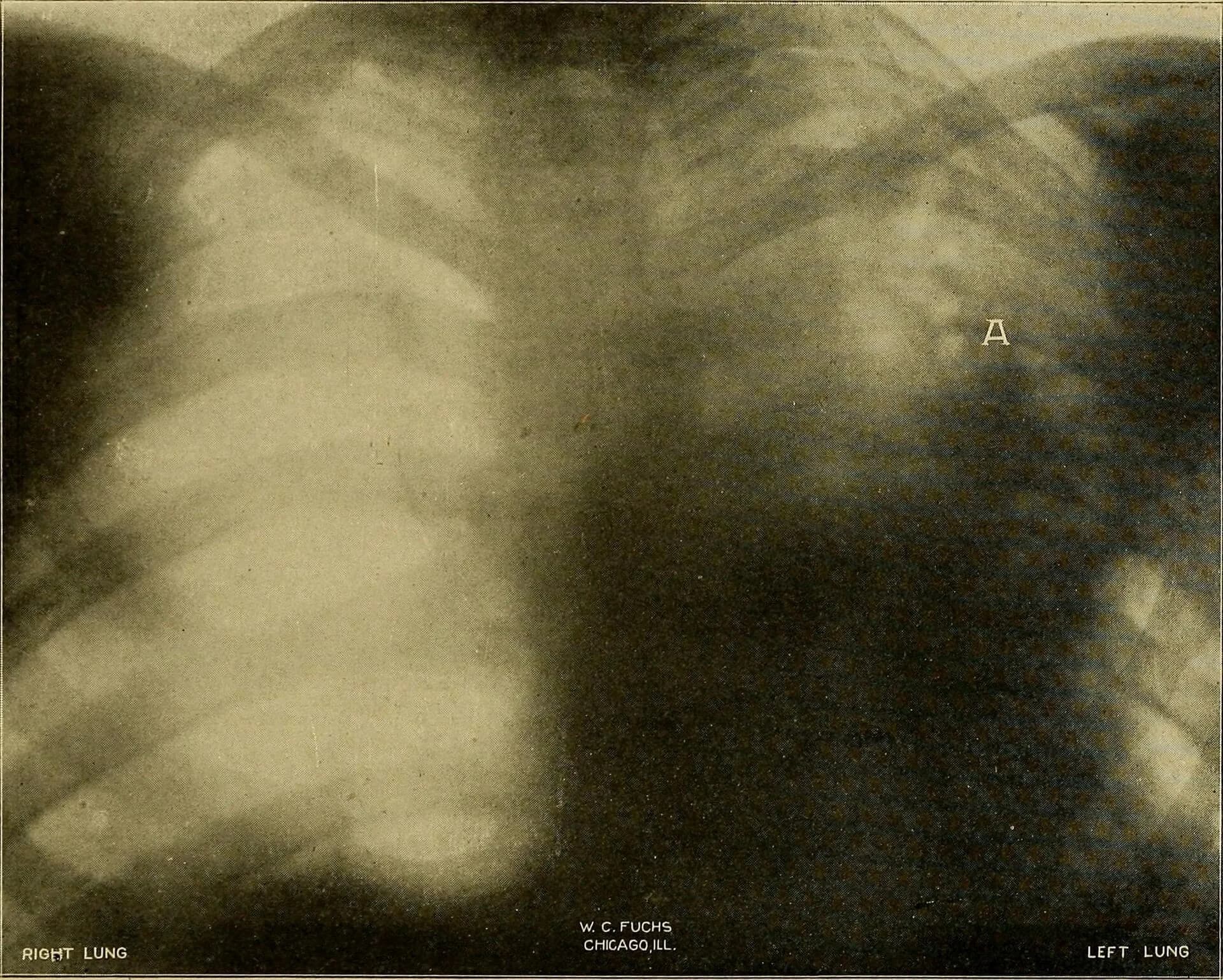 An early X-ray photograph from a medical textbook